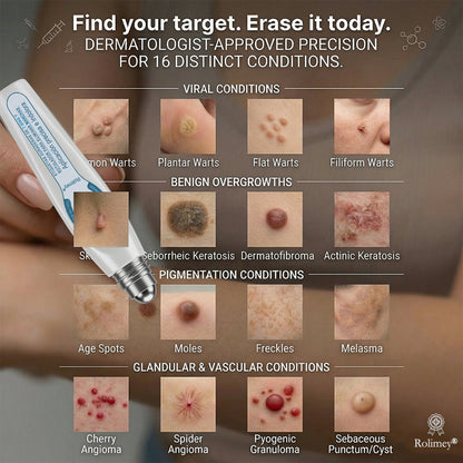 ✨🇨🇦 Official Canada Store | Rolimey® 7-Day Skin Tag & Blemish Roll-On – Painless & Scar-Free