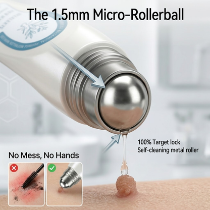 ✨🇨🇦 Official Canada Store | Rolimey® 7-Day Skin Tag & Blemish Roll-On – Painless & Scar-Free